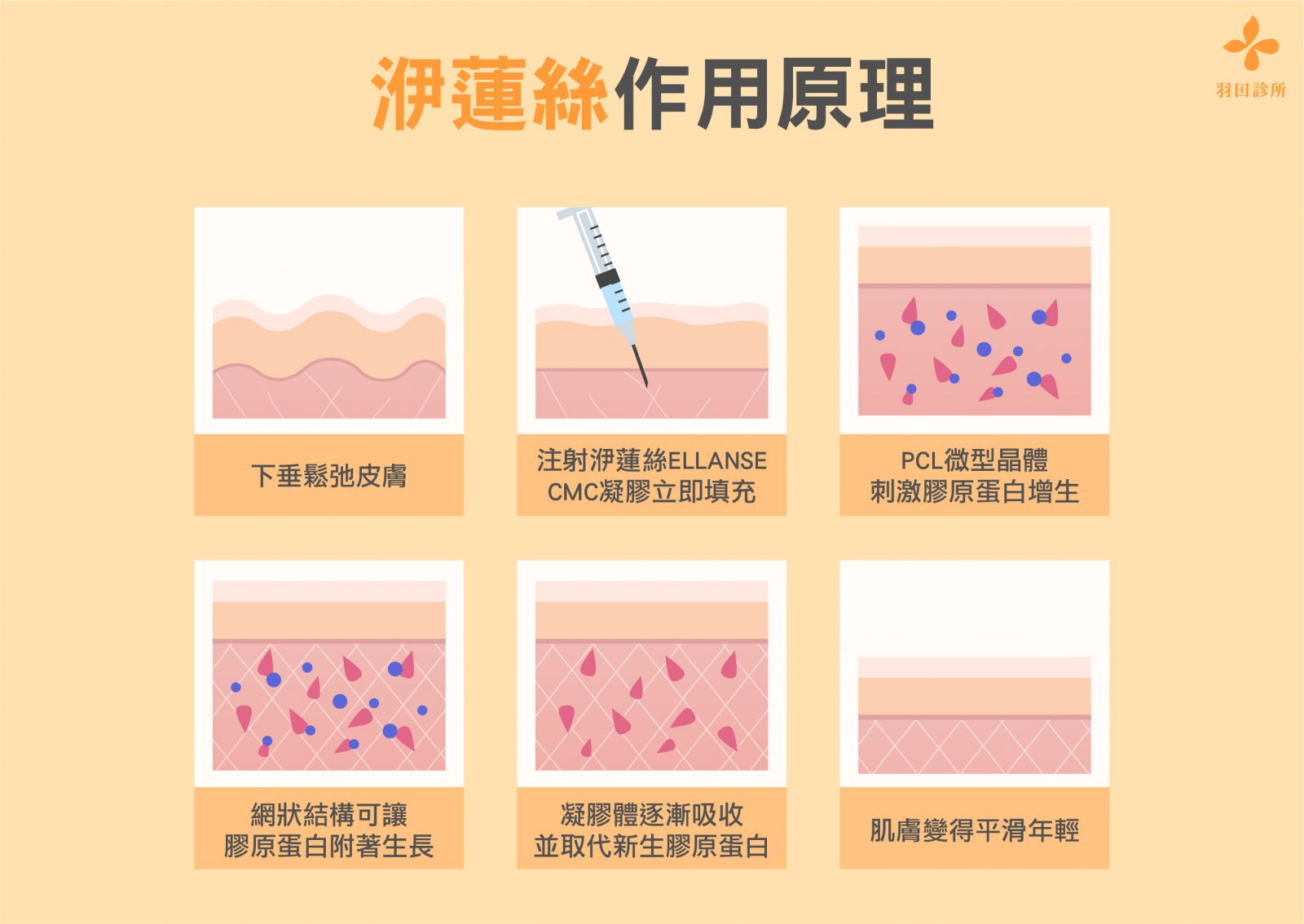 羽田診所吳佩謙醫師說明EllANSÉ洢蓮絲作用原理