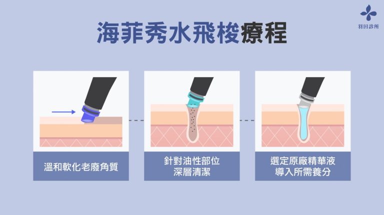 羽田診所吳佩謙醫師製圖說明海菲秀水飛梭療程過程